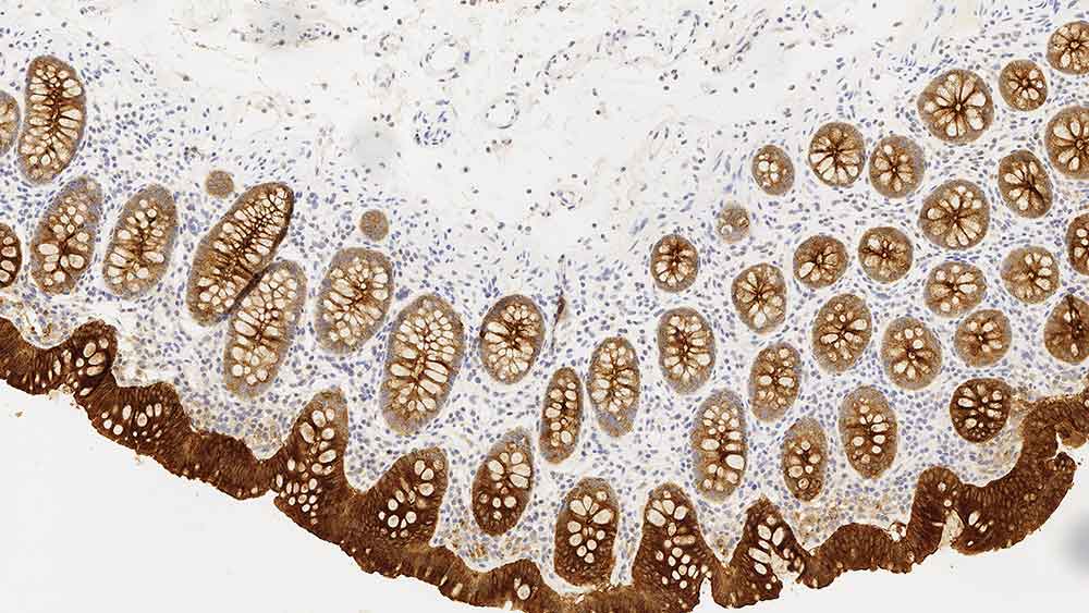 Carcinoembryonic-Antigen-(CD66e)---COL-1---PA0848 CD200:CD200R1